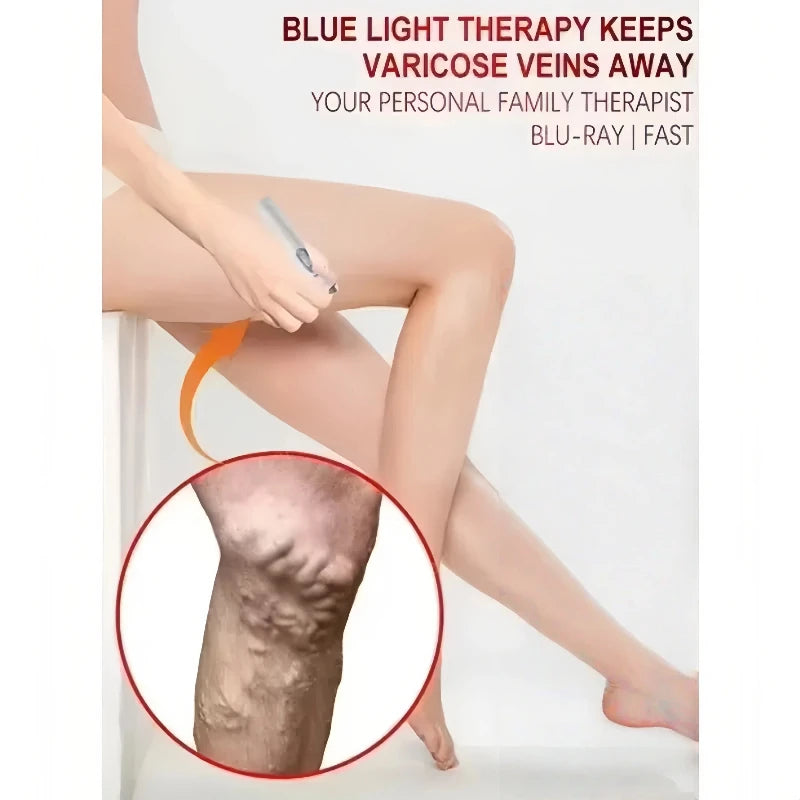 Blue Light Laser Vein Therapy | At-Home Treatment for Spider Veins & Swelling | Safe for Couperose Skin