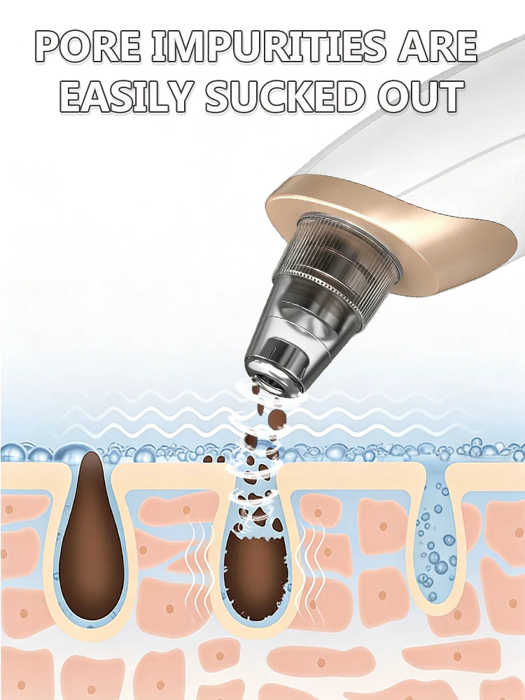 Blackhead Remover Pore Cleaner Skin Pimple Acne Extractor Facial Cleaning Electric Black Head Removal Black Dots Vacuum Cleaner