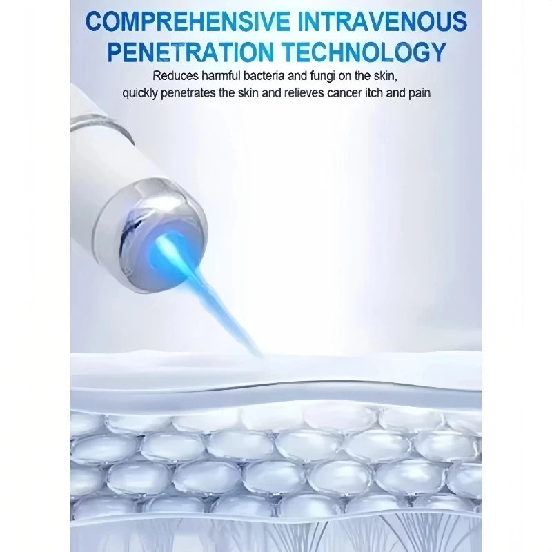 Blue Light Laser Vein Therapy | At-Home Treatment for Spider Veins & Swelling | Safe for Couperose Skin