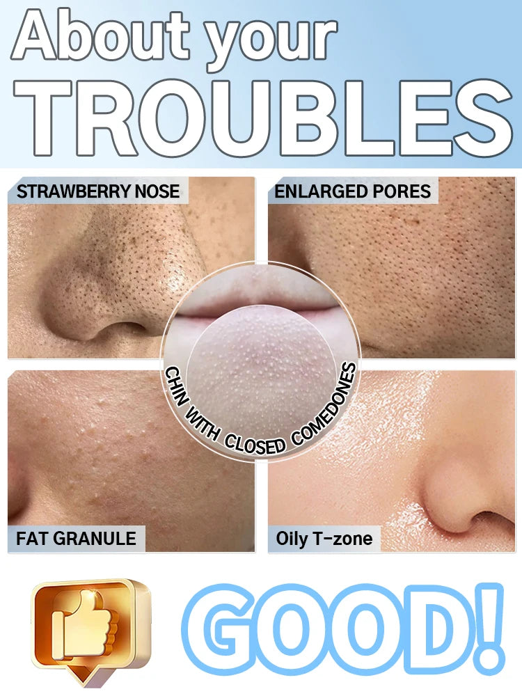 Blackhead Remover Pore Cleaner Skin Pimple Acne Extractor Facial Cleaning Electric Black Head Removal Black Dots Vacuum Cleaner