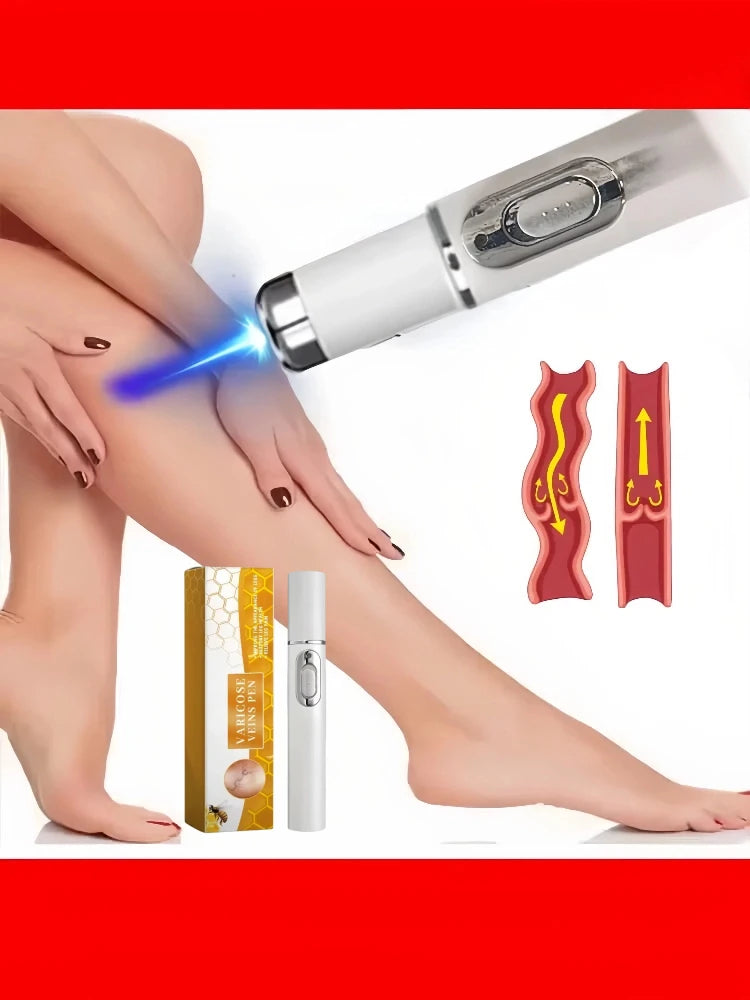 Blue Light Laser Vein Therapy | At-Home Treatment for Spider Veins & Swelling | Safe for Couperose Skin