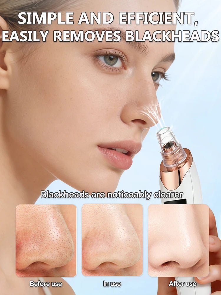 Blackhead Remover Pore Cleaner Skin Pimple Acne Extractor Facial Cleaning Electric Black Head Removal Black Dots Vacuum Cleaner