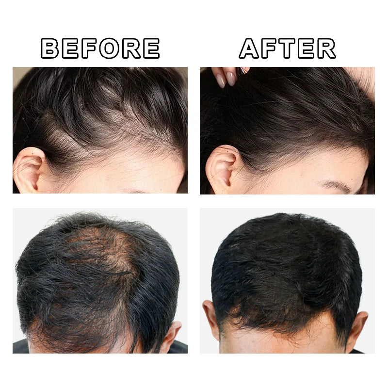 GINZO Hair Concealer for Baldness Dye Hair Corrector Cream for Man Waterproof Fill Up Black Hair Powder Upgraded Home Use 40ml