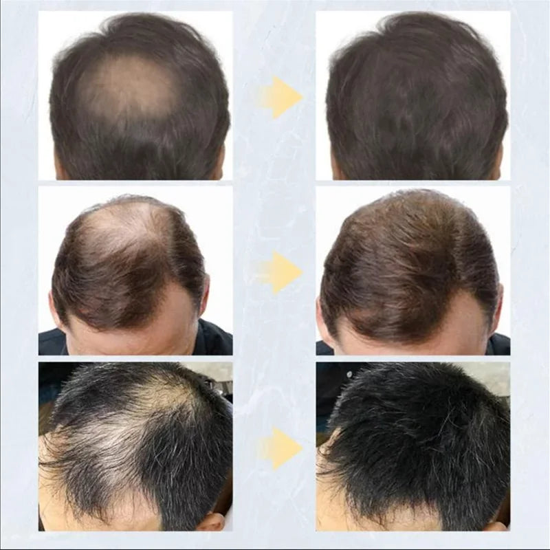 20pcsHair Fiber Keratin Hair Building Fiber Powder Instant Hair Growth Thickening Hairline Gaps Fiber Bald Extension Care Produc