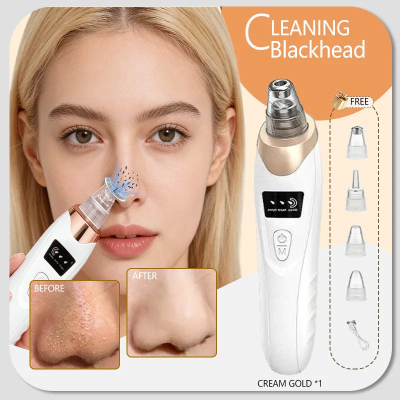 Blackhead Remover Pore Cleaner Skin Pimple Acne Extractor Facial Cleaning Electric Black Head Removal Black Dots Vacuum Cleaner