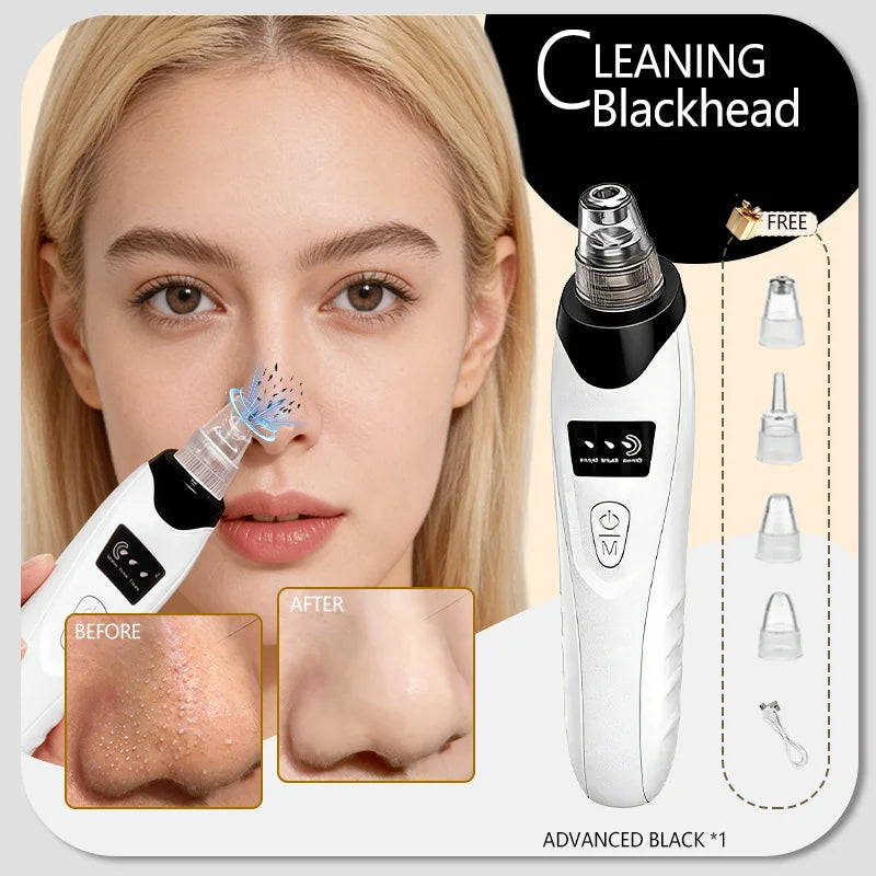Blackhead Remover Pore Cleaner Skin Pimple Acne Extractor Facial Cleaning Electric Black Head Removal Black Dots Vacuum Cleaner
