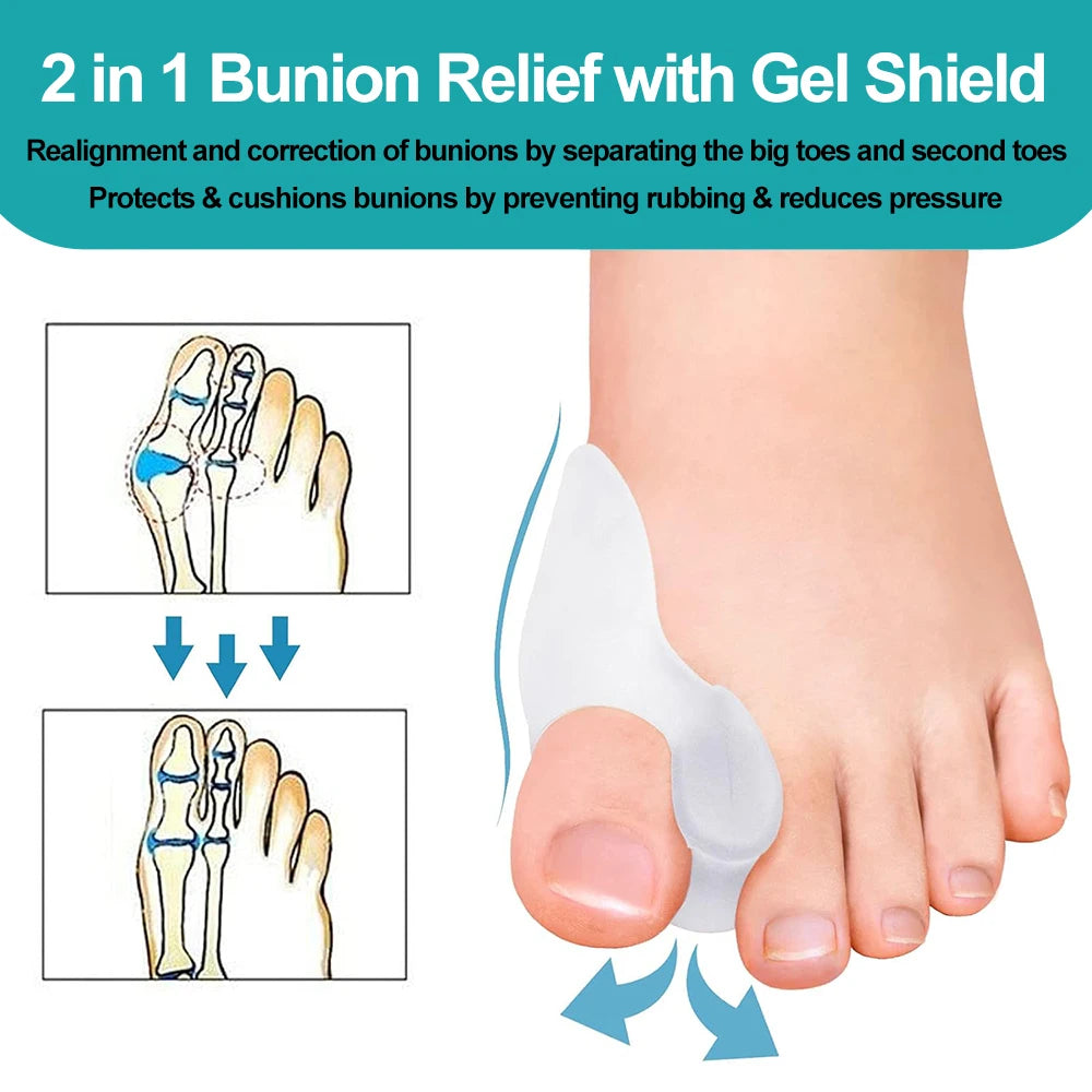 1Pair Silicone Gel Thumb Corrector Bunion Little Toe Protector Separator Hallux Valgus Finger Straightener Foot Care Relief Pads