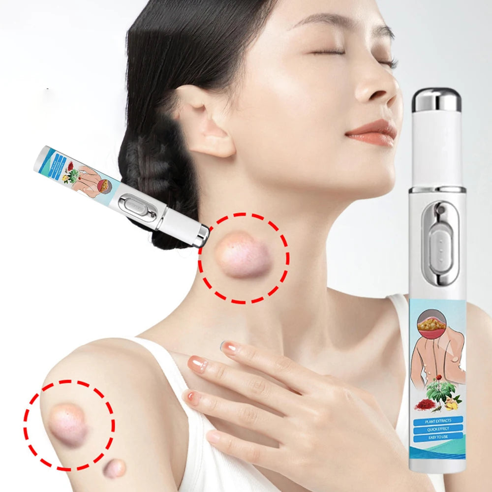 Lipoma Removal Laser Pointer Efficiently Removes Lipoma Fibroids Subcutaneous Lumps Body Health Care