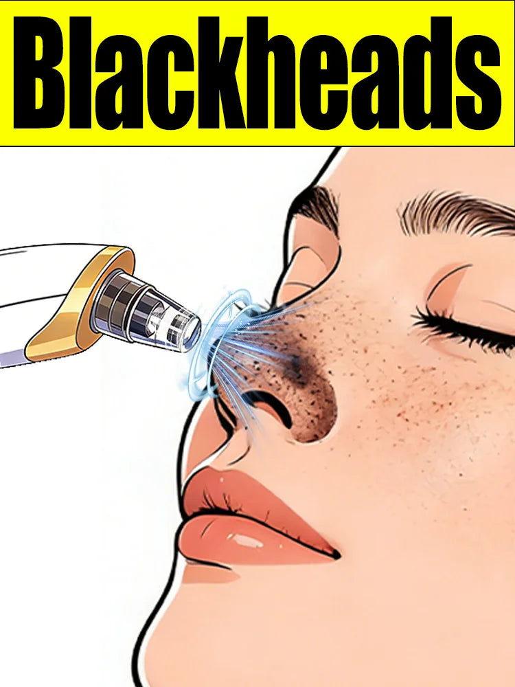 Blackhead Remover Pore Cleaner Skin Pimple Acne Extractor Facial Cleaning Electric Black Head Removal Black Dots Vacuum Cleaner
